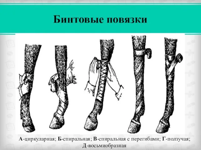 Бинтовые повязки А-циркуларная; Б-спиральная; В-спиральная с перегибами; Г-ползучая; Д-восьмиобразная