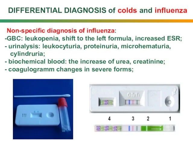 DIFFERENTIAL DIAGNOSIS of colds and influenza Non-specific diagnosis of influenza: GBC: leukopenia,