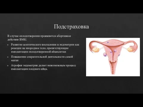 Подстраховка В случае оплодотворения проявляется абортивное действие ВМК: Развитие асептического воспаления в