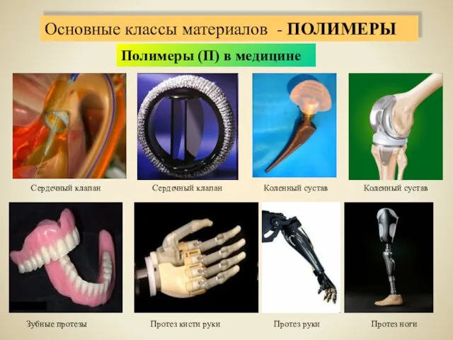 Полимеры (П) в медицине Сердечный клапан Сердечный клапан Коленный сустав Коленный сустав