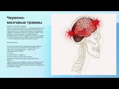 Черепно-мозговые травмы Черепно-мозговые травмы Частный случай перелома — повреждение костей черепа. Если