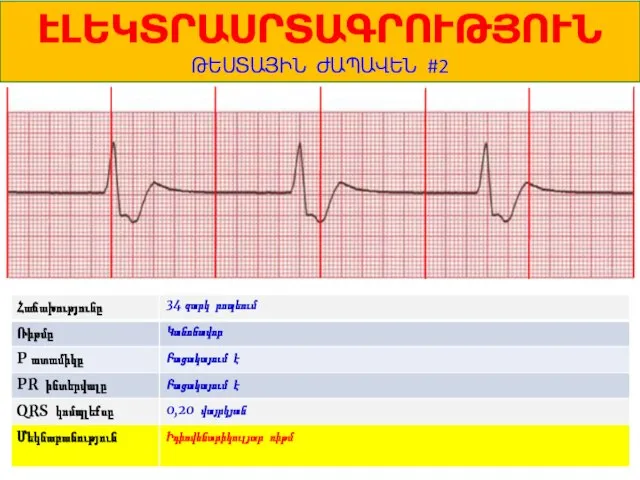 1 ԷԼԵԿՏՐԱՍՐՏԱԳՐՈՒԹՅՈՒՆ ԹԵՍՏԱՅԻՆ ԺԱՊԱՎԵՆ #2 34 զարկ րոպեում Կանոնավոր Բացակայում է Բացակայում