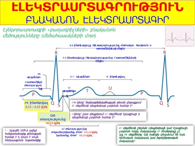 ԷԼԵԿՏՐԱՍՐՏԱԳՐՈՒԹՅՈՒՆ ԲՆԱԿԱՆՈՆ ԷԼԵԿՏՐԱՍՐՏԱԳԻՐ Էլեկտրասրտագրի «բաղադրիչների» բնականոն մեծությունները (մեծահասակների մոտ) R-R ինտերվալը (հեռավորությունը