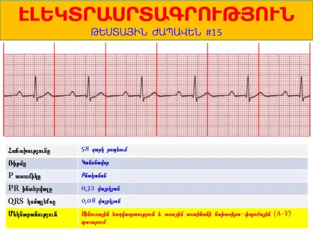 1 ԷԼԵԿՏՐԱՍՐՏԱԳՐՈՒԹՅՈՒՆ ԹԵՍՏԱՅԻՆ ԺԱՊԱՎԵՆ #15 58 զարկ րոպեում Կանոնավոր Բնականոն 0,32 վայրկյան