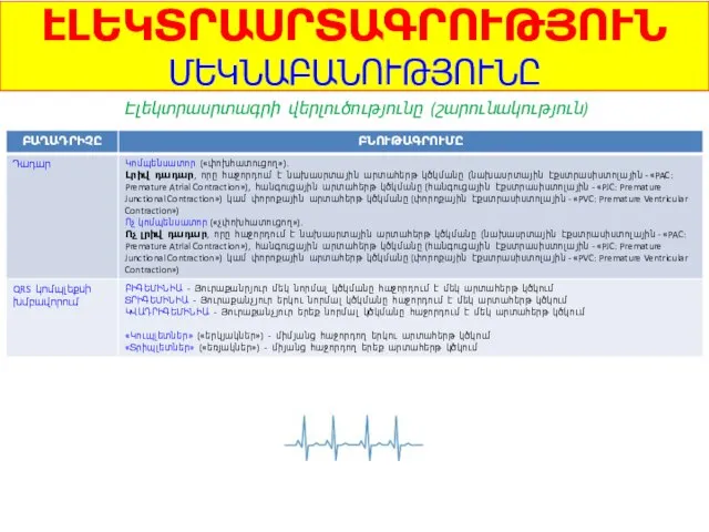 ԷԼԵԿՏՐԱՍՐՏԱԳՐՈՒԹՅՈՒՆ ՄԵԿՆԱԲԱՆՈՒԹՅՈՒՆԸ Էլեկտրասրտագրի վերլուծությունը (շարունակություն)