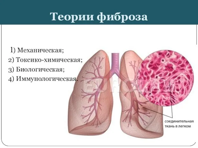 Теории фиброза 1) Механическая; 2) Токсико-химическая; 3) Биологическая; 4) Иммунологическая.