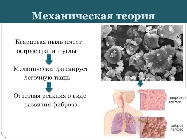 Механическая теория Кварцевая пыль имеет острые грани и углы Механически травмирует легочную