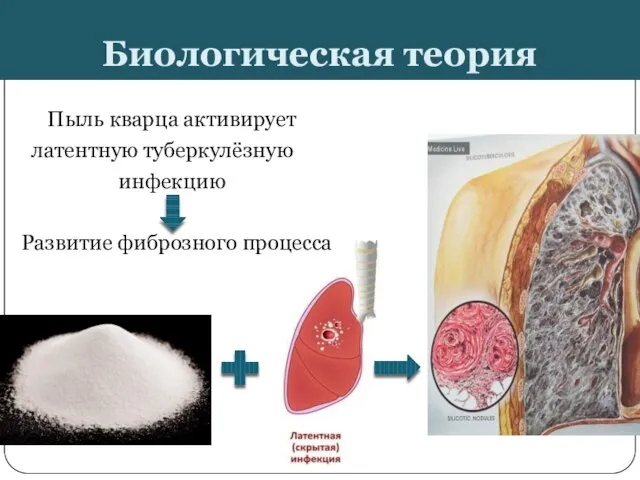 Биологическая теория Пыль кварца активирует латентную туберкулёзную инфекцию Развитие фиброзного процесса
