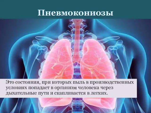 Пневмокониозы Это состояния, при которых пыль в производственных условиях попадает в организм