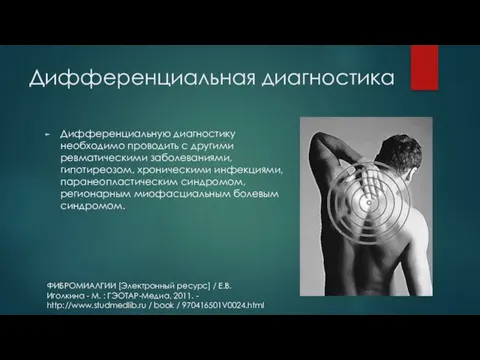 Дифференциальная диагностика Дифференциальную диагностику необходимо проводить с другими ревматическими заболеваниями, гипотиреозом, хроническими