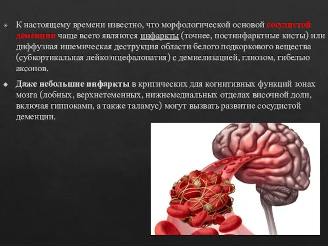 К настоящему времени известно, что морфологической основой сосудистой деменции чаще всего являются