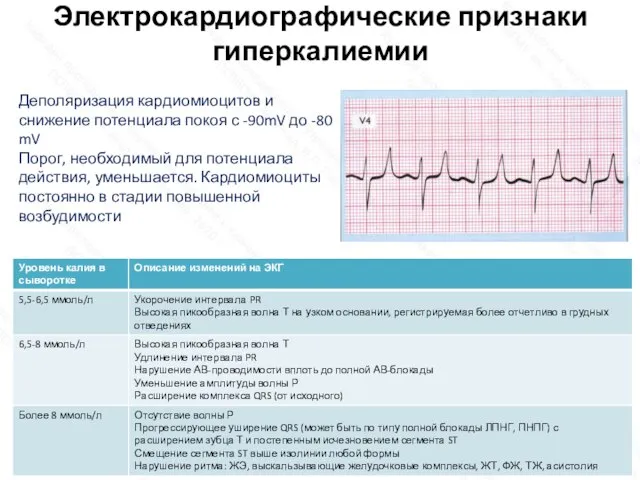 Электрокардиографические признаки гиперкалиемии Деполяризация кардиомиоцитов и снижение потенциала покоя с -90mV до