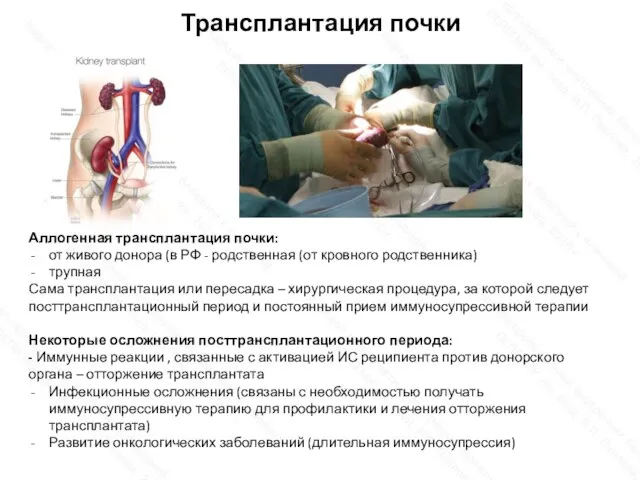 Трансплантация почки Аллогенная трансплантация почки: от живого донора (в РФ - родственная