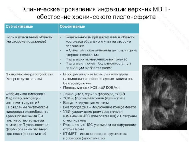 Клинические проявления инфекции верхних МВП - обострение хронического пиелонефрита