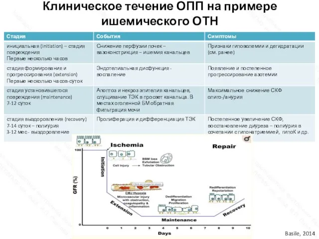 Клиническое течение ОПП на примере ишемического ОТН Basile, 2014