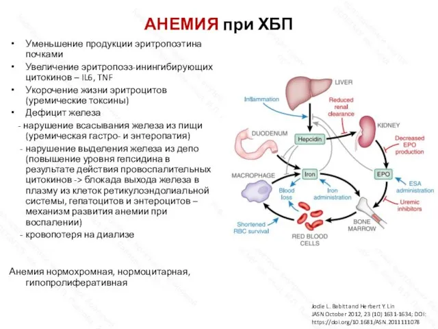 АНЕМИЯ при ХБП Уменьшение продукции эритропоэтина почками Увеличение эритропоэз-инингибирующих цитокинов – IL6,