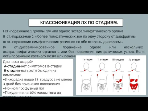 КЛАССИФИКАЦИЯ ЛХ ПО СТАДИЯМ. I ст.-поражение 1 группы л/у или одного экстралимфатического