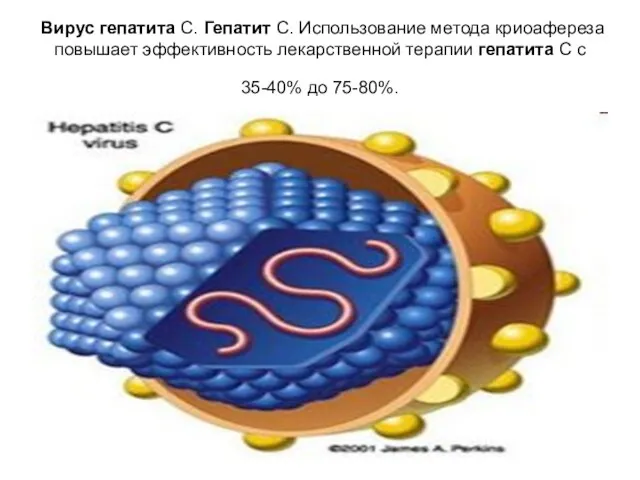 Вирус гепатита C. Гепатит С. Использование метода криоафереза повышает эффективность лекарственной терапии