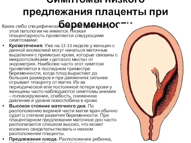 Симптомы низкого предлежания плаценты при беременности Каких-либо специфических внешних признаков у этой