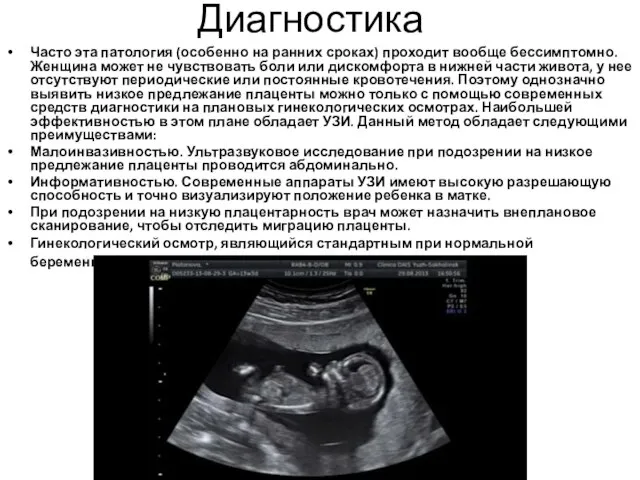 Диагностика Часто эта патология (особенно на ранних сроках) проходит вообще бессимптомно. Женщина