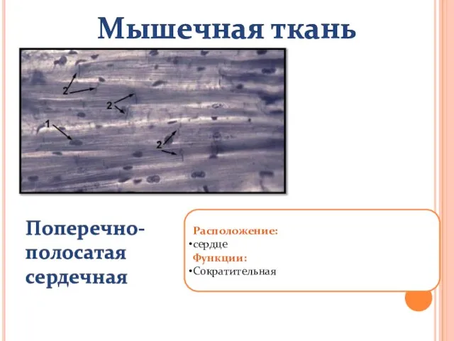 Мышечная ткань Поперечно-полосатая сердечная Расположение: сердце Функции: Сократительная Мышечная ткань Поперечно-полосатая сердечная Мышечная ткань Поперечно-полосатая сердечная