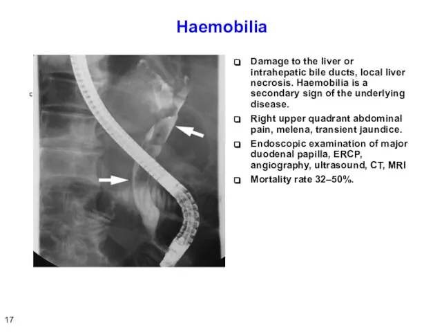 Haemobilia Damage to the liver or intrahepatic bile ducts, local liver necrosis.