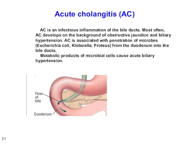 Acute cholangitis (AC) AC is an infectious inflammation of the bile ducts.