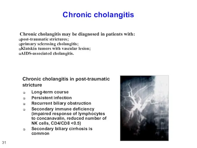 Chronic cholangitis Chronic cholangitis may be diagnosed in patients with: post-traumatic strictures;