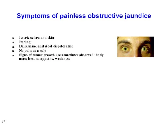 Symptoms of painless obstructive jaundice Icteric sclera and skin Itching Dark urine