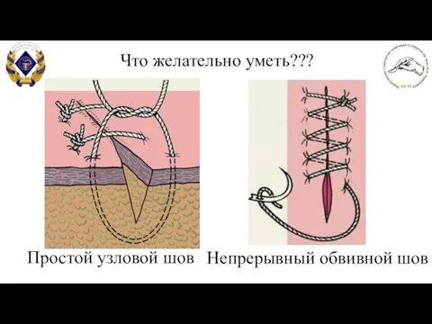 Что желательно уметь??? Непрерывный обвивной шов