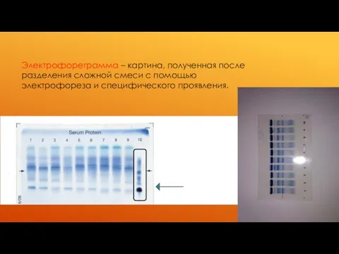 Электрофореграмма – картина, полученная после разделения сложной смеси с помощью электрофореза и специфического проявления.