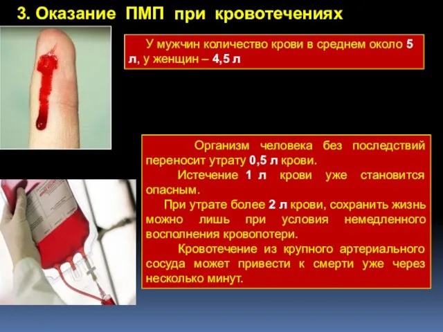 3. Оказание ПМП при кровотечениях Организм человека без последствий переносит утрату 0,5