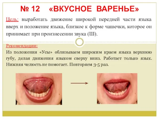 № 12 «ВКУСНОЕ ВАРЕНЬЕ» Цель: выработать движение широкой передней части языка вверх