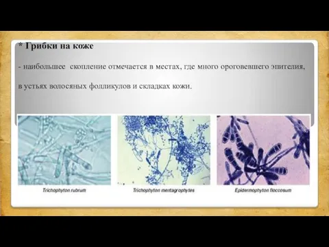 * Грибки на коже - наибольшее скопление отмечается в местах, где много