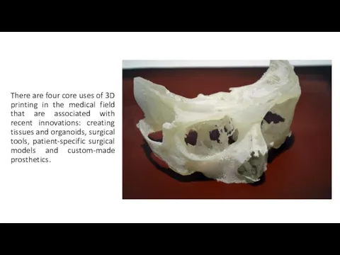 There are four core uses of 3D printing in the medical field