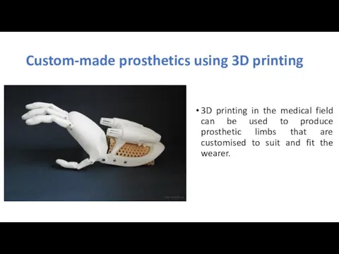 Custom-made prosthetics using 3D printing 3D printing in the medical field can