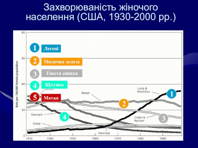 Захворюваність жіночого населення (США, 1930-2000 рр.) 3 2 2 5 1 1