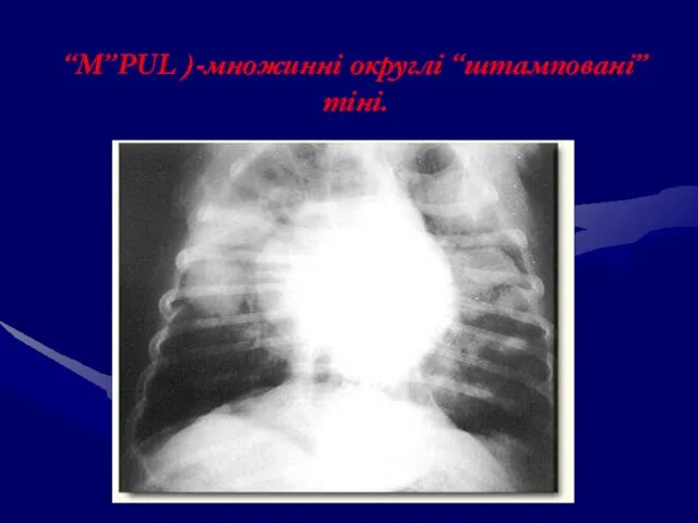 “М”PUL )-множинні округлі “штамповані” тіні.