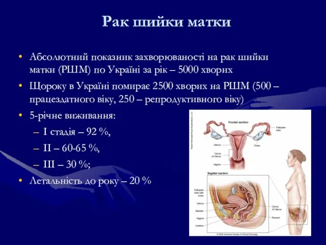 Рак шийки матки Абсолютний показник захворюваності на рак шийки матки (РШМ) по
