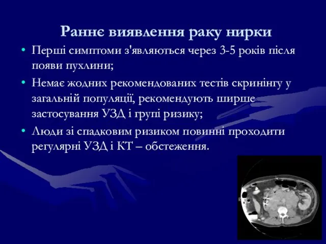 Раннє виявлення раку нирки Перші симптоми з'являються через 3-5 років після появи