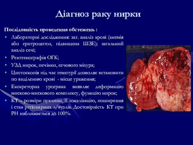 Діагноз раку нирки Послідовність проведення обстежень : Лабораторні дослідження: заг. аналіз крові