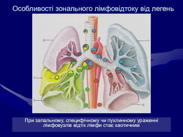 Особливості зонального лімфовідтоку від легень При запальному, специфічному чи пухлинному ураженні лімфовузлів відтік лімфи стає хаотичним