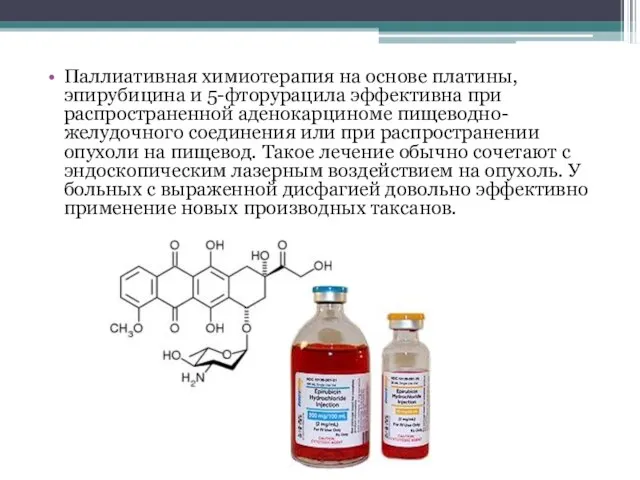 Паллиативная химиотерапия на основе платины, эпирубицина и 5-фторурацила эффективна при распространенной аденокарциноме