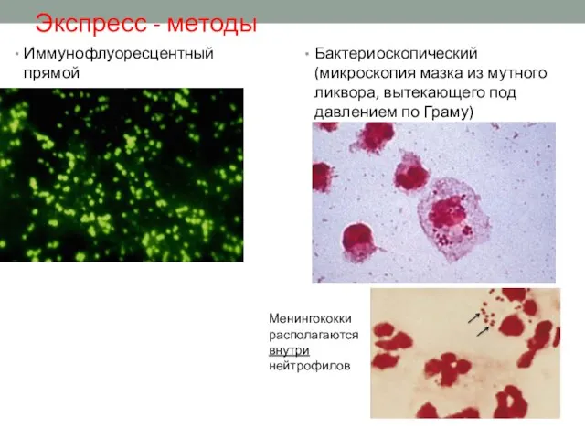 Экспресс - методы Бактериоскопический (микроскопия мазка из мутного ликвора, вытекающего под давлением