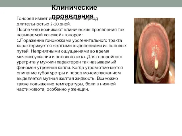 Клинические проявления Гонорея имеет инкубационный период длительностью 2-10 дней. После чего возникают