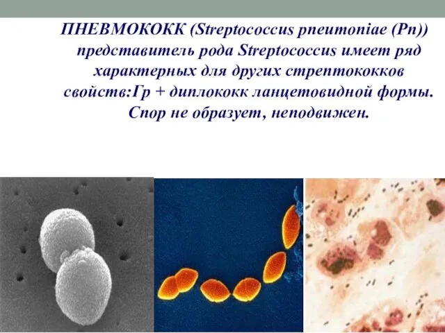 ПНЕВМОКОКК (Streptococcus pneumoniae (Рn)) представитель рода Streptococcus имеет ряд характерных для других