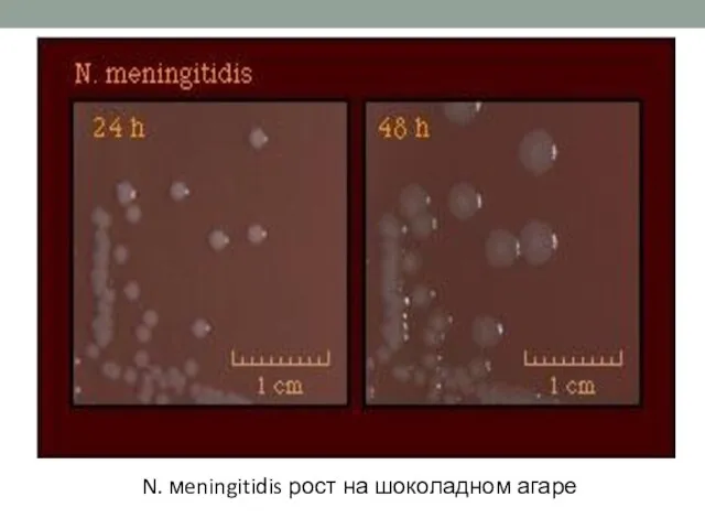 N. мeningitidis рост на шоколадном агаре