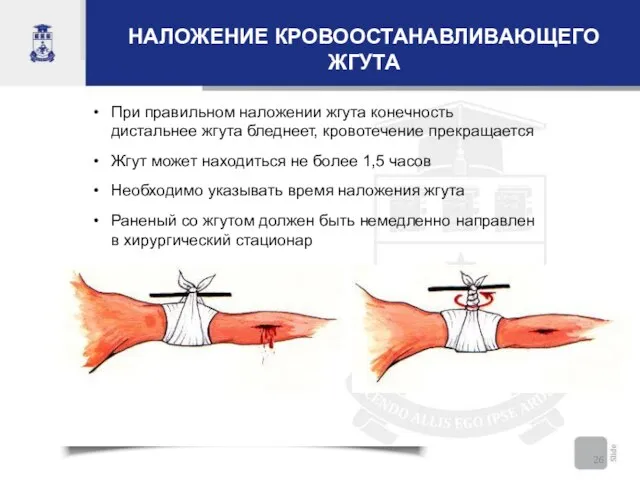 НАЛОЖЕНИЕ КРОВООСТАНАВЛИВАЮЩЕГО ЖГУТА При правильном наложении жгута конечность дистальнее жгута бледнеет, кровотечение