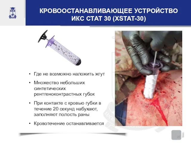 КРОВООСТАНАВЛИВАЮЩЕЕ УСТРОЙСТВО ИКС СТАТ 30 (XSTAT-30) Где не возможно наложить жгут Множество