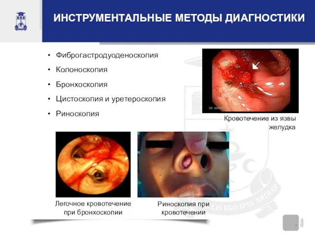 ИНСТРУМЕНТАЛЬНЫЕ МЕТОДЫ ДИАГНОСТИКИ Фиброгастродуоденоскопия Колоноскопия Бронхоскопия Цистоскопия и уретероскопия Риноскопия Кровотечение из